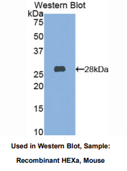 https://msimg.bioon.com/bionline/goods-no-pic.png