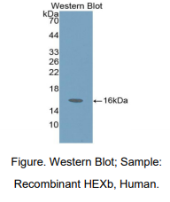 人氨基己糖苷酶Bβ(HEXb)多克隆抗体