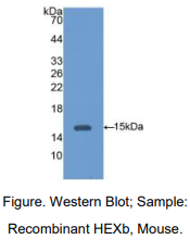 https://msimg.bioon.com/bionline/goods-no-pic.png