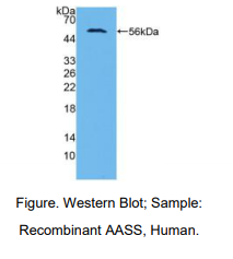 https://msimg.bioon.com/bionline/goods-no-pic.png