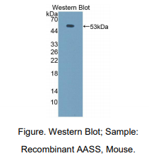 https://msimg.bioon.com/bionline/goods-no-pic.png