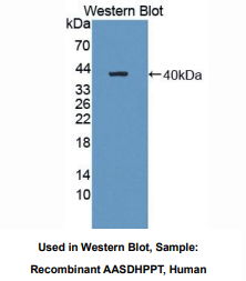 https://msimg.bioon.com/bionline/goods-no-pic.png