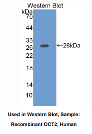 https://msimg.bioon.com/bionline/goods-no-pic.png