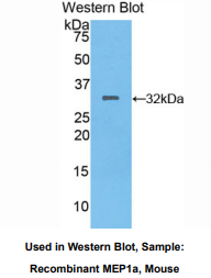 小鼠安眠蛋白1α(MEP1a)多克隆抗体