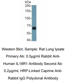 人白介素18受体1(IL18R1)多克隆抗体