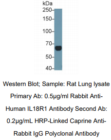 https://msimg.bioon.com/bionline/goods-no-pic.png