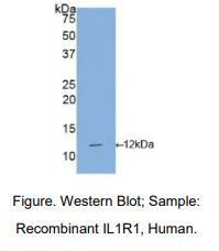 https://msimg.bioon.com/bionline/goods-no-pic.png