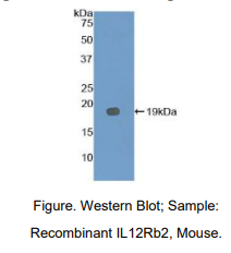 https://msimg.bioon.com/bionline/goods-no-pic.png