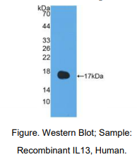 https://msimg.bioon.com/bionline/goods-no-pic.png