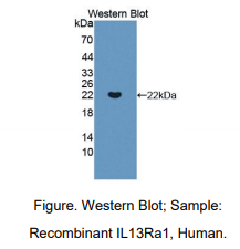 https://msimg.bioon.com/bionline/goods-no-pic.png