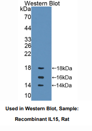 https://msimg.bioon.com/bionline/goods-no-pic.png