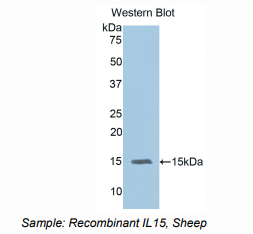 https://msimg.bioon.com/bionline/goods-no-pic.png