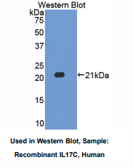 https://msimg.bioon.com/bionline/goods-no-pic.png