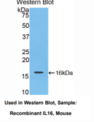 https://msimg.bioon.com/bionline/goods-no-pic.png