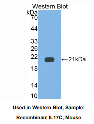 https://msimg.bioon.com/bionline/goods-no-pic.png