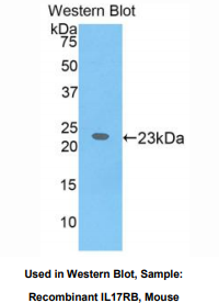 小鼠白介素17受体B(IL17RB)多克隆抗体