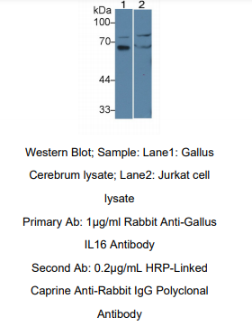 https://msimg.bioon.com/bionline/goods-no-pic.png