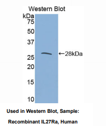 https://msimg.bioon.com/bionline/goods-no-pic.png