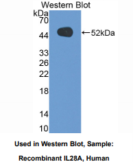 https://msimg.bioon.com/bionline/goods-no-pic.png