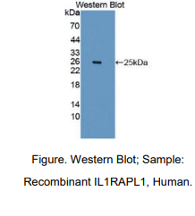 https://msimg.bioon.com/bionline/goods-no-pic.png