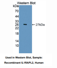 https://msimg.bioon.com/bionline/goods-no-pic.png