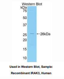 https://msimg.bioon.com/bionline/goods-no-pic.png