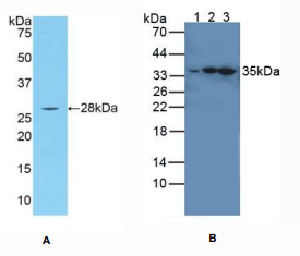 人白介素1受体关联激酶4(IRAK4)多克隆抗体