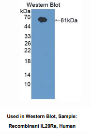 人白介素20受体α(IL20Ra)多克隆抗体