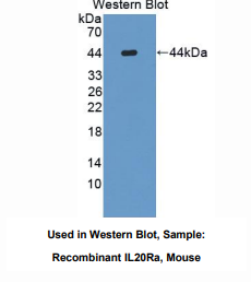 小鼠白介素20受体α(IL20Ra)多克隆抗体