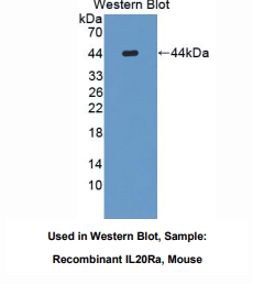 https://msimg.bioon.com/bionline/goods-no-pic.png