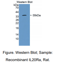 https://msimg.bioon.com/bionline/goods-no-pic.png