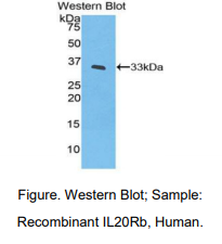 人模白介素20受体β(IL20Rb)多克隆抗体