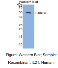 人白介素21(IL21)多克隆抗体