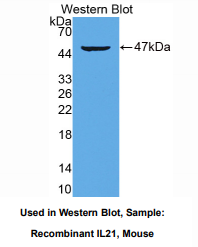 https://msimg.bioon.com/bionline/goods-no-pic.png