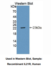 https://msimg.bioon.com/bionline/goods-no-pic.png