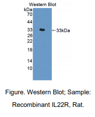 https://msimg.bioon.com/bionline/goods-no-pic.png