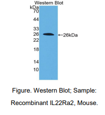 https://msimg.bioon.com/bionline/goods-no-pic.png