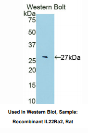 大鼠白介素22受体α2(IL22Ra2)多克隆抗体