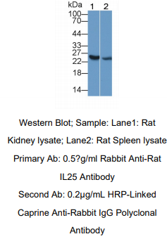 https://msimg.bioon.com/bionline/goods-no-pic.png