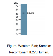 https://msimg.bioon.com/bionline/goods-no-pic.png