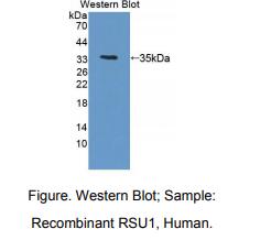 https://msimg.bioon.com/bionline/goods-no-pic.png