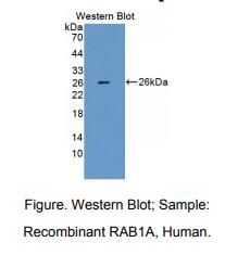 人RAS癌基因家族成员RAB1A(RAB1A)多克隆抗体