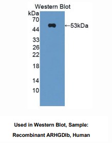 https://msimg.bioon.com/bionline/goods-no-pic.png