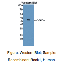 https://msimg.bioon.com/bionline/goods-no-pic.png