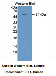 https://msimg.bioon.com/bionline/goods-no-pic.png