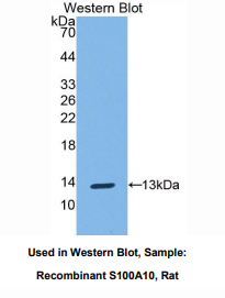 大鼠S100钙结合蛋白A10(S100A10)多克隆抗体