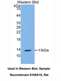 https://msimg.bioon.com/bionline/goods-no-pic.png