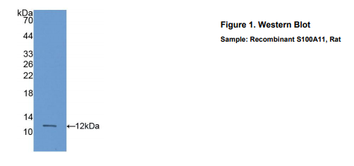 大鼠S100钙结合蛋白A11(S100A11)多克隆抗体