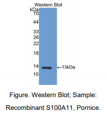 https://msimg.bioon.com/bionline/goods-no-pic.png