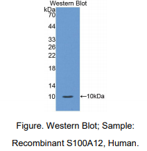人S100钙结合蛋白A12(S100A12)多克隆抗体